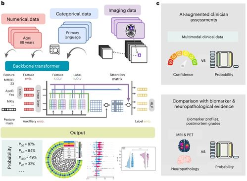 人工智能基礎軟件助力失智癥快速診斷